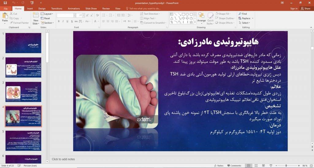 پاورپوینت هایپرتیروئیدی دانشجوی پزشکی